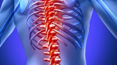 8 أعراض للإصابة بالانزلاق الغضروفي للفتيات.. واستشاري يوضح طرق الوقاية