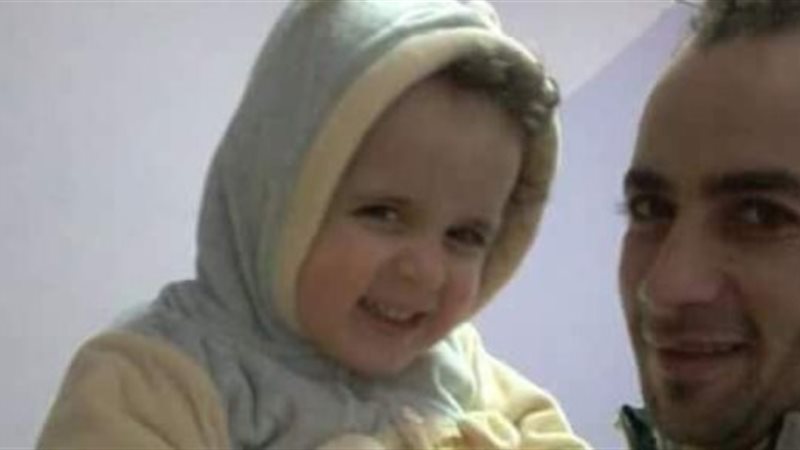 حرقا على يد والده