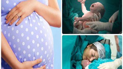 نصفى ولا كلي.. أفضل طريقة للتخدير قبل الولادة القيصرية