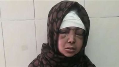 ضرتها حاولت قتلها .. محامى «سيدة الساطور» يكشف تطورات حالتها الصحية 