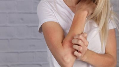 أسباب الإصابة بـ«حكة الجلد» بعد انقطاع الدورة الشهرية