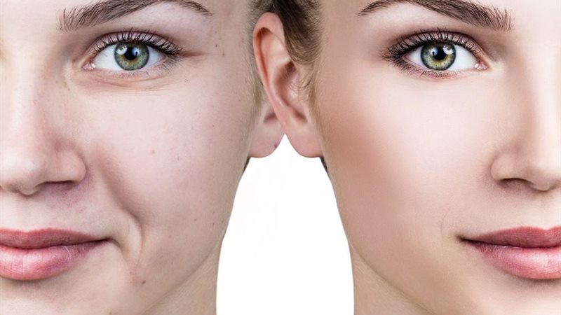 استعيدي شبابك بهذا