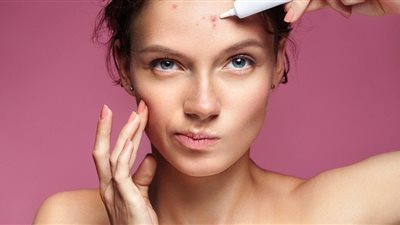 خلطة طبيعية لإخفاء الحبوب.. تعرفي عليها 