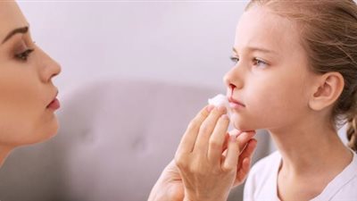 المرض الملكي.. كل ما تريدين معرفته عن الهيموفيليا 