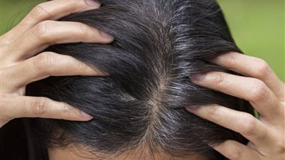 «بالبطاطس والبيض» إزاي تعالجي تساقط شعرك بأكلات من مطبخك