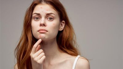 لـ«المراهقات».. إليكِ 4 خطوات للعناية اليومية ببشرتك لإطلالة جذابة