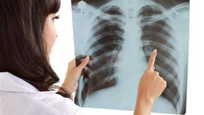 منها فقدان الوزن.. 7 أعراض مبكرة لسرطان الرئة عند النساء