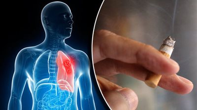 «الصحة» تكشف عن أضرار التدخين بالرئتين والأوعية الدموية