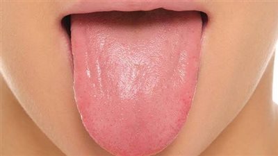 «النزيف».. أبرز أعراض سرطان اللسان و3 طرق للعلاج