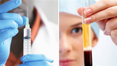 أمنية عبدالحكيم: «البلازما» تستخدم في علاج أمراض الكبد والكلى