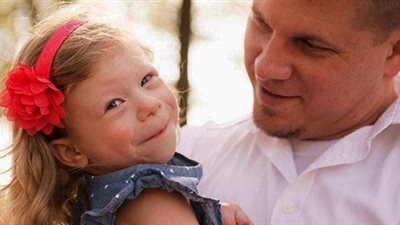 متلازمة ويليامز.. ما هي وكيف تتعاملين معها؟