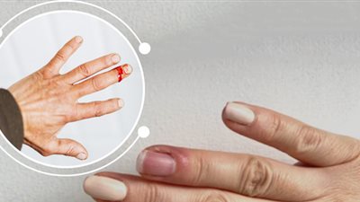 ألم في أظافر الأصابع؟ احذري من 6 مشاكل بالأظافر