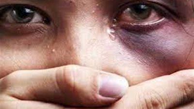 أب يشوه وجه ابنته بماء النار: كنت فاكرها أمها