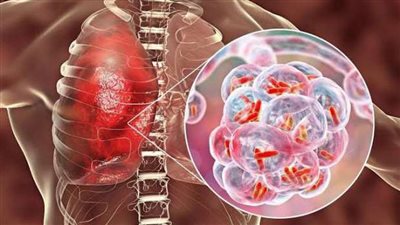 هذه الفئات هم الأكثر عرضة للإصابة بفيروس دلتا بلس: طالع التفاصيل