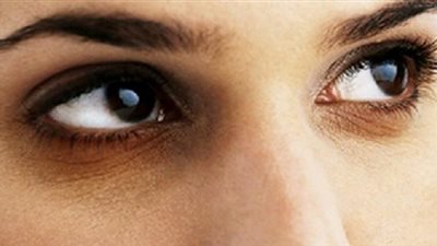 أسباب غير متوقعة للهالات تحت العين أبرزها 