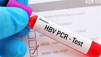 جدل حول موثوقية الـ PCR في الكشف عن الإصابة بكورونا