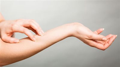 يُصيب الإناث قبل البلوغ.. اعرفي كل شيء عن مرض حساسية الماء