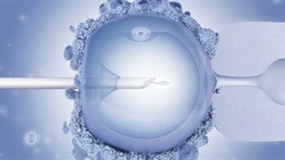 استشاري أمراض نساء توضح أسباب اللجوء لـ