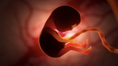 استشاري نساء وتوليد يكشف أسباب الإجهاض المتكرر.. و5 حلول لمنعه