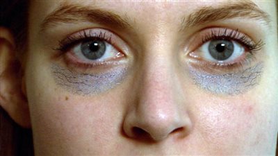 تخلصي من «الهالات السوداء» نهائيًّا.. بطرق طبيعية