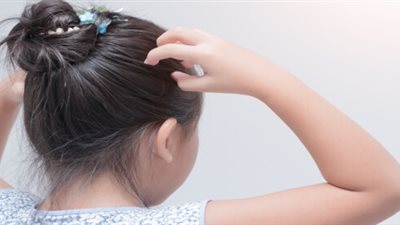 غير «القمل».. 5 أسباب لحكة الرأس عند الأطفال