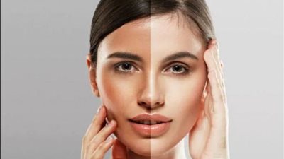 خلطات طبيعية لتفتيح لون البشرة.. «البطاطس والبرتقال والزبادي»