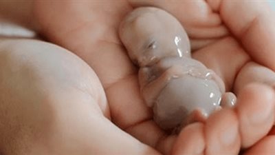 استشاري توليد يكشف أسباب ومخاطر الحمل الضعيف   