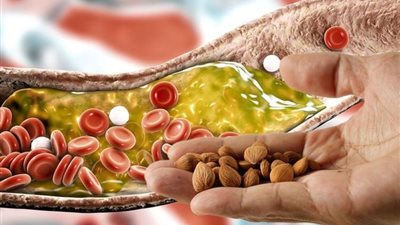 دراسة جديدة: الأطعمة والمشروبات البنية تزيد خطر الإصابة بالسرطان