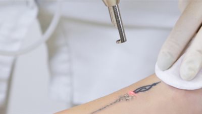 تفسير رؤيا الوشم في المنام للعزباء والمتزوجة والحامل