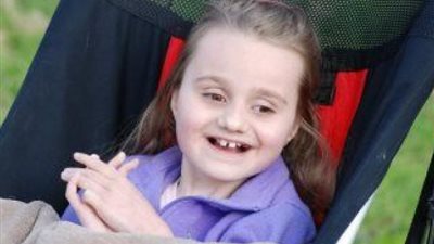 أمراض نسائية.. متلازمتي «تيرنر» و«ريت» تصيبان النساء فقط