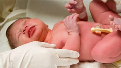 طبيب أطفال: يجب زيارة الطفل الرضيع للطبيب بعد ولادته بثلاثة أيام لهذه الأسباب