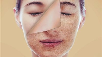 للبنات في رمضان.. نصائح للحماية من جفاف البشرة مع الصيام والصيف