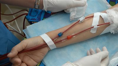 فتاوى رمضان| هل يجوز إجراء الغسيل الكلوي أثناء الصيام؟ «الإفتاء» تجيب