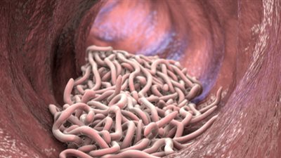 رأيت الدود يخرج من فمي في المنام.. اعرفي تفسير الحلم بالتفصيل