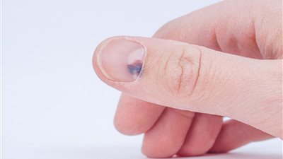 تفسير رؤيا سقوط الظافر في المنام وعلاقتها بالخداع في قصة حب