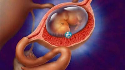 «ممارسة العلاقة الحميمة بشكل خاطئ».. أسباب الحمل خارج الرحم ومضاعفاته وكيفية تشخيصه