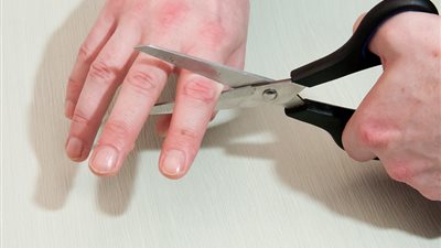 رأيت إصبعي مقطوعًا في المنام.. اعرفي تفسير الحلم