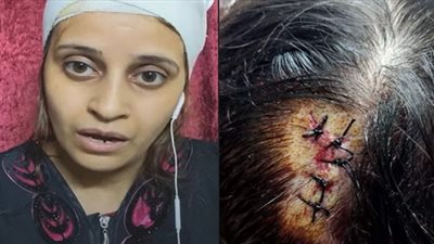 «في استجابة سريعة» الداخلية تُنقذ «ماري مجدي» ضحية العنف الزوجي| فيديو
