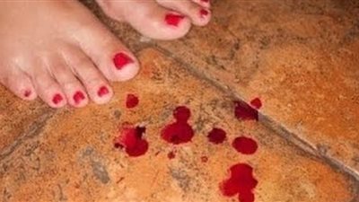 تفسير حلم نزيف الدم للسيدات وعلاقته بمشاكل منتظرة