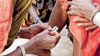 «الأورام العصبية والتشوه».. أضرار تُصيب المختونات من النساء