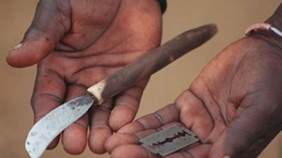 «6 فبراير» اليوم العالمي لرفض تشويه الأعضاء التناسلية للإناث