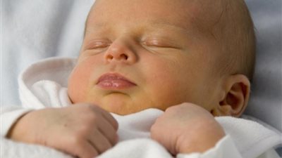 صفراء حديثي الولادة.. طبيبة: «التكسيرية» أخطر نوع وتؤثر على المخ