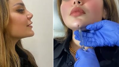 «مكتفتش بجمالها» ابنة هيفاء وهبي توضح تفاصيل خضوعها لجراحات تجميل