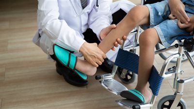 بعد الطفلة رقية.. تعرف على أنواع ضمور العضلات الوراثي