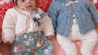 استغاثة جديدة.. والد سارة وسدرة يُناشد الرئيس لعلاجهم  من الضمور الشوكي