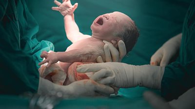 طبيب يكشف تفاصيل مثيرة في حالة سيدة أصبحت أما في 13 دقيقة| فيديو