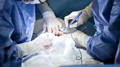 حكم استخدام الليزر في الجراحة ومدى اعتباره من الكيّ المنهي عنه.. الإفتاء تُجيب