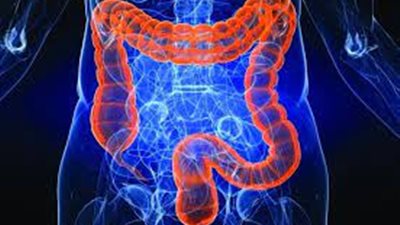 استشاري مسالك بولية يوضح لـ«هير نيوز» أنواع البواسير وأعراضها