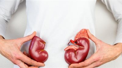 هل الارتفاع المفاجئ لوظائف الكلى خطر؟.. حسام موافي يجيب| فيديو