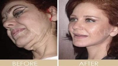 ميادة الحناوي عن حقيقة خضوعها لعمليات التجميل: 